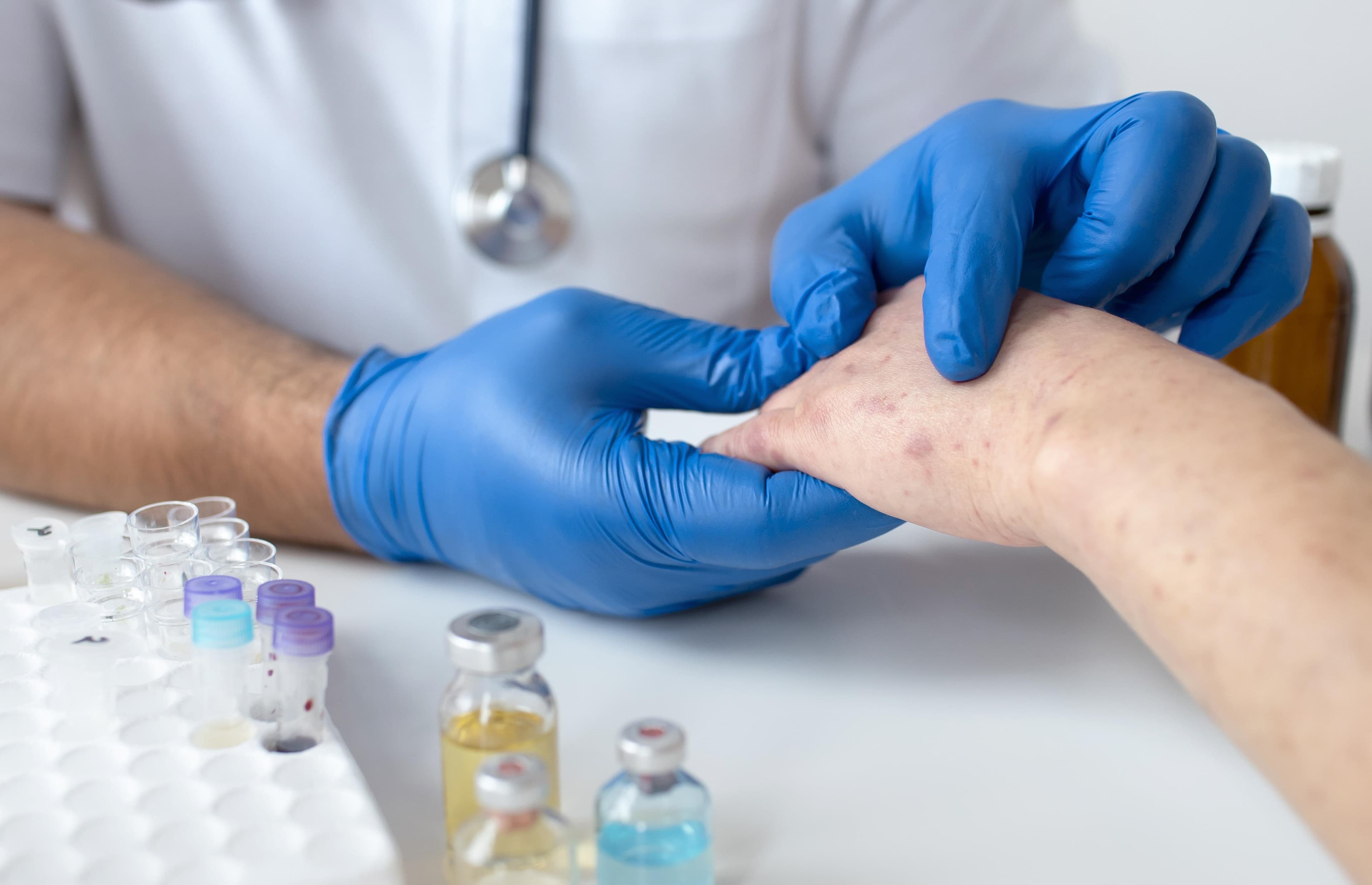 Anaphylaxis CE